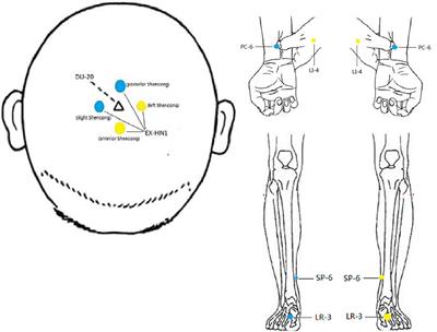 The modulation of mRNA levels of MAOA by electroacupuncture and psychotherapy in patients with pathological internet use